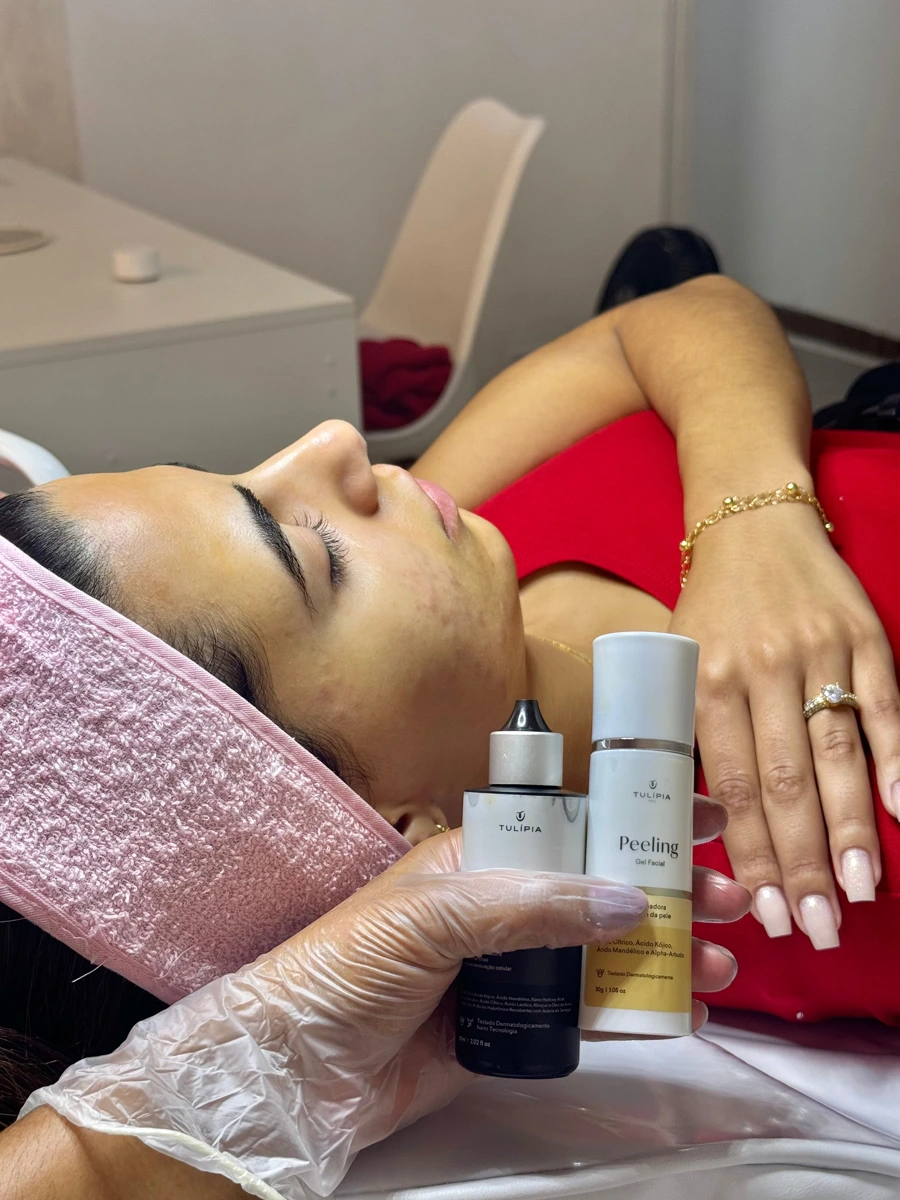 Imagem do catálogo: Peeling químico